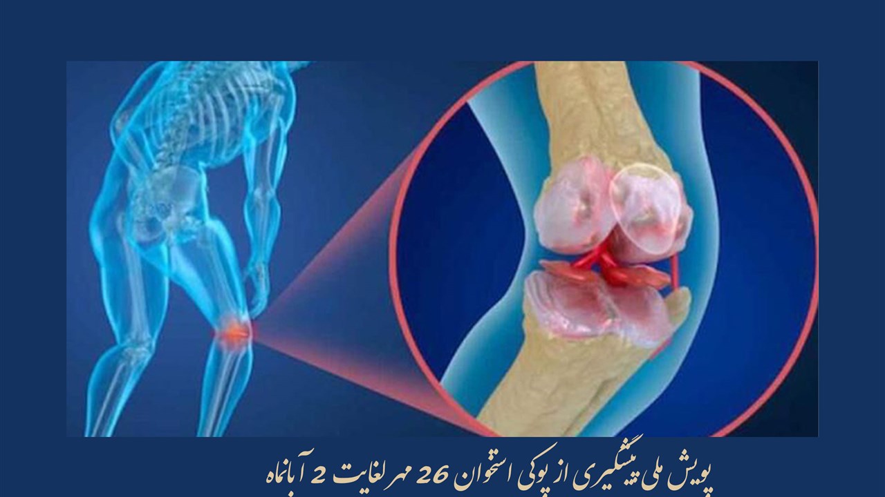 پویش ملی پیشگیری از پوکی استخوان 26 لغایت 2 آبانما